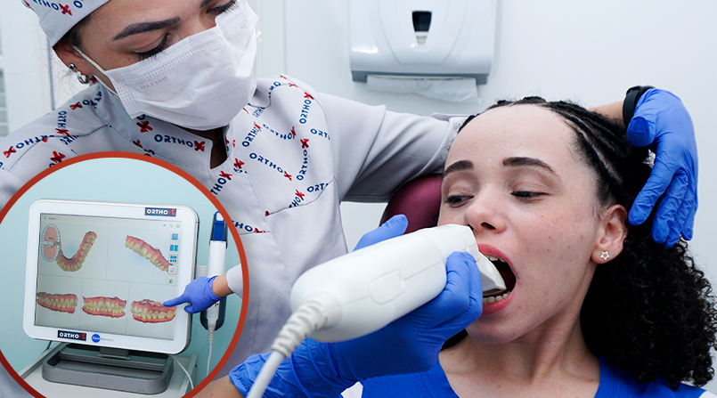 OrthoX - Site - Entenda como realizamos os modelos ortodônticos 3D